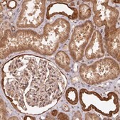 Anti-ZNF322 antibody produced in rabbit Prestige Antibodies® Powered by Atlas Antibodies, affinity isolated antibody, buffered aqueous glycerol solution