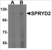 Anti-CMYA5 antibody produced in rabbit affinity isolated antibody