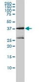 Monoclonal Anti-MAGEA2 antibody produced in mouse clone 1H4, purified immunoglobulin, buffered aqueous solution