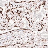 Monoclonal Anti-KLF4 antibody produced in mouse Prestige Antibodies&#174; Powered by Atlas Antibodies, clone CL5782, purified immunoglobulin, buffered aqueous glycerol solution
