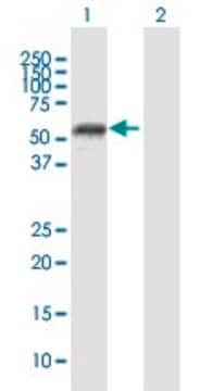 Anti-MMP1 antibody produced in mouse purified immunoglobulin, buffered aqueous solution