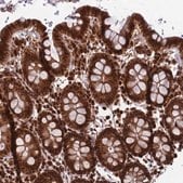 Anti-FUBP3 antibody produced in rabbit Prestige Antibodies&#174; Powered by Atlas Antibodies, affinity isolated antibody, buffered aqueous glycerol solution