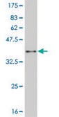 Monoclonal Anti-HSPB1 antibody produced in mouse clone 3G3, purified immunoglobulin, buffered aqueous solution