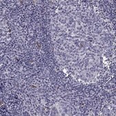 Anti-ANKS4B antibody produced in rabbit Prestige Antibodies&#174; Powered by Atlas Antibodies, affinity isolated antibody, buffered aqueous glycerol solution