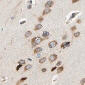 Anti-LRRC47 antibody produced in rabbit Prestige Antibodies® Powered by Atlas Antibodies, affinity isolated antibody, buffered aqueous glycerol solution