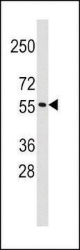 ANTI-RNF36 (TRIM69) (CENTER H215) antibody produced in rabbit purified immunoglobulin, buffered aqueous solution