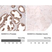 Monoclonal Anti-Adam10 Antibody Produced In Mouse Prestige Antibodies&#174; Powered by Atlas Antibodies, clone CL13815, affinity isolated antibody, buffered aqueous glycerol solution