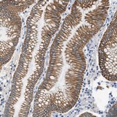Anti-SLC6A6 antibody produced in rabbit Prestige Antibodies&#174; Powered by Atlas Antibodies, affinity isolated antibody, buffered aqueous glycerol solution, Ab2