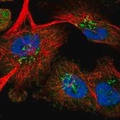 Anti-RPUSD1 antibody produced in rabbit Prestige Antibodies&#174; Powered by Atlas Antibodies, affinity isolated antibody, buffered aqueous glycerol solution
