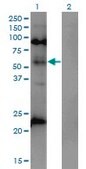 Monoclonal Anti-MECP2 antibody produced in mouse clone 4B6, purified immunoglobulin, buffered aqueous solution