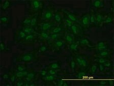 Monoclonal Anti-KLF11 antibody produced in mouse clone 8F4, purified immunoglobulin, buffered aqueous solution