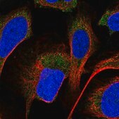 Anti-PPM1A antibody produced in rabbit Prestige Antibodies&#174; Powered by Atlas Antibodies, affinity isolated antibody, buffered aqueous glycerol solution