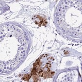 Anti-SMIM21 antibody produced in rabbit Prestige Antibodies&#174; Powered by Atlas Antibodies, affinity isolated antibody, buffered aqueous glycerol solution