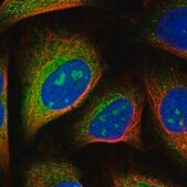 Anti-FAM102B antibody produced in rabbit Prestige Antibodies® Powered by Atlas Antibodies, affinity isolated antibody, buffered aqueous glycerol solution