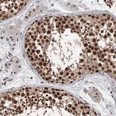 Anti-CHD1L antibody produced in rabbit Prestige Antibodies&#174; Powered by Atlas Antibodies, affinity isolated antibody, buffered aqueous glycerol solution
