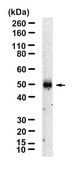 Anti-SPARC Antibody, clone 5N19 ZooMAb® Rabbit Monoclonal recombinant, expressed in HEK 293 cells