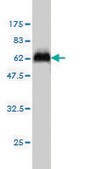 Monoclonal Anti-STK16 antibody produced in mouse clone M2, purified immunoglobulin, buffered aqueous solution