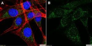 Anti-STIM1 Antibody, clone 2H7 ZooMAb® Rabbit Monoclonal recombinant, expressed in HEK 293 cells