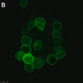 Anti-Anosmin Antibody, clone 2C17 ZooMAb® Rabbit Monoclonal recombinant, expressed in HEK 293 cells