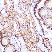 Anti-NDRG1 antibody produced in rabbit