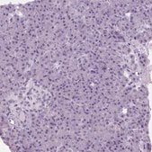 Anti-MYOM1 antibody produced in rabbit Prestige Antibodies&#174; Powered by Atlas Antibodies, affinity isolated antibody, buffered aqueous glycerol solution