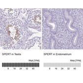 Anti-SPERT antibody produced in rabbit Prestige Antibodies® Powered by Atlas Antibodies, affinity isolated antibody, buffered aqueous glycerol solution