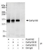 Rabbit anti-Caf1p150 Antibody, Affinity Purified Powered by Bethyl Laboratories, Inc.