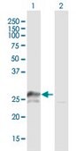 Anti-TFAM antibody produced in mouse purified immunoglobulin, buffered aqueous solution