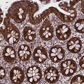 Anti-MPND antibody produced in rabbit Prestige Antibodies&#174; Powered by Atlas Antibodies, affinity isolated antibody, buffered aqueous glycerol solution