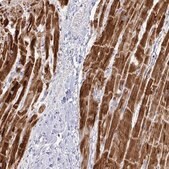 Anti-NDUFA7 antibody produced in rabbit Prestige Antibodies&#174; Powered by Atlas Antibodies, affinity isolated antibody, buffered aqueous glycerol solution