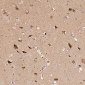 Anti-HTT antibody produced in rabbit Prestige Antibodies&#174; Powered by Atlas Antibodies, affinity isolated antibody, buffered aqueous glycerol solution