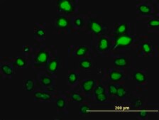 Monoclonal Anti-SAE1 antibody produced in mouse clone 1G4-1G5, purified immunoglobulin, buffered aqueous solution
