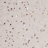 Anti-RBM6 antibody produced in rabbit Prestige Antibodies® Powered by Atlas Antibodies, affinity isolated antibody, buffered aqueous glycerol solution, Ab1