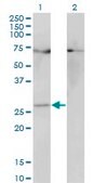 ANTI-HOXB7 antibody produced in mouse clone 3F3, purified immunoglobulin, buffered aqueous solution