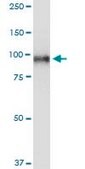 Monoclonal Anti-TOP1 antibody produced in mouse clone 1A1, purified immunoglobulin, buffered aqueous solution