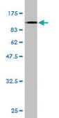 Monoclonal Anti-FLNA antibody produced in mouse clone 4E10-1B2, purified immunoglobulin, buffered aqueous solution