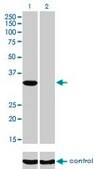 Monoclonal Anti-ITPK1 antibody produced in mouse clone 2C8, purified immunoglobulin, buffered aqueous solution