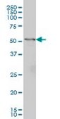 Monoclonal Anti-GPT antibody produced in mouse clone 1F10, ascites fluid