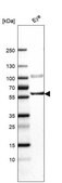 Anti-ENTPD2 antibody produced in rabbit Prestige Antibodies&#174; Powered by Atlas Antibodies, affinity isolated antibody, buffered aqueous glycerol solution