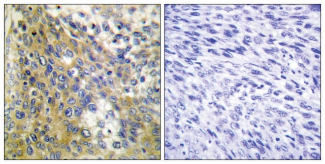 Anti-Collagen IV &#945;6 antibody produced in rabbit affinity isolated antibody