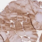 Anti-SMYD1 antibody produced in rabbit Prestige Antibodies&#174; Powered by Atlas Antibodies, affinity isolated antibody, buffered aqueous glycerol solution