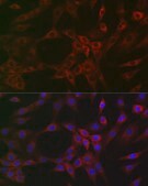 Anti-ARPC2 Antibody, clone 4F2G6, Rabbit Monoclonal