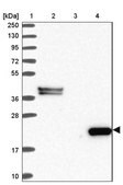 Anti-C8G antibody produced in rabbit Prestige Antibodies&#174; Powered by Atlas Antibodies, affinity isolated antibody, buffered aqueous glycerol solution