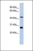 Anti-SYT9 antibody produced in rabbit affinity isolated antibody