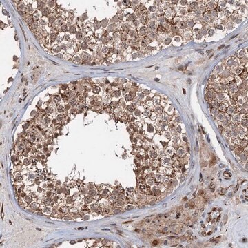 Anti-TMA16 antibody produced in rabbit Prestige Antibodies&#174; Powered by Atlas Antibodies, affinity isolated antibody, buffered aqueous glycerol solution