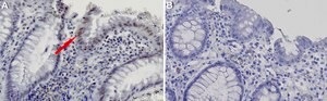 Anti-p-Histone H3.3 (S31) Antibody, clone 2I12 ZooMAb&#174; Rabbit Monoclonal recombinant, expressed in HEK 293 cells