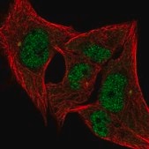 Anti-ANP32A antibody produced in rabbit Prestige Antibodies&#174; Powered by Atlas Antibodies, affinity isolated antibody, buffered aqueous glycerol solution