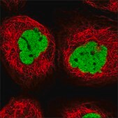 Anti-PP2D1 antibody produced in rabbit Prestige Antibodies® Powered by Atlas Antibodies, affinity isolated antibody, buffered aqueous glycerol solution