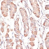 Anti-ATP5A1 antibody produced in rabbit