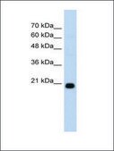 Anti-FBXO25 IgG fraction of antiserum